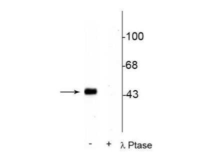 Western Blot: CREB [p Ser133] Antibody [NB300-273]